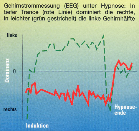 EEG-Darstellung während einer Hypnose